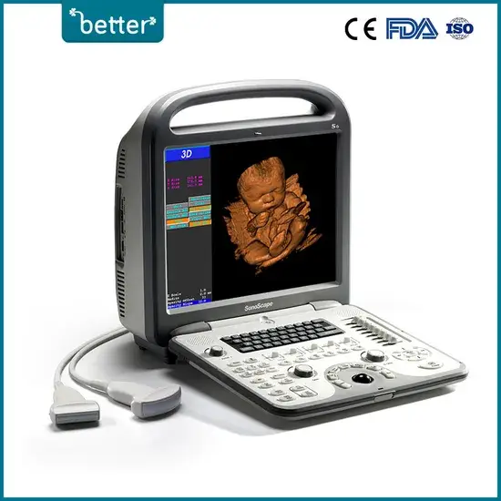Máy quét siêu âm Doppler màu Sonoscape S6 - Thiết bị chẩn đoán siêu âm cho bệnh viện hình ảnh 1-description