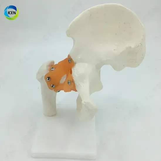 Che dấu vết M13: Model mô phỏng khớp hông - Phương pháp giáo dục về cơ thể hình ảnh 1-description