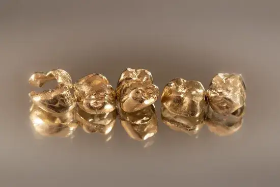 Răng giả sứ zirconia tùy chỉnh - Phương pháp phục hình nha khoa hiện đại hình ảnh 1-description